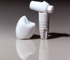 Zirconia Implant in Dubai