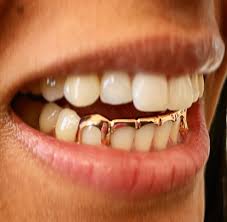 Gold Teeth in Dubai